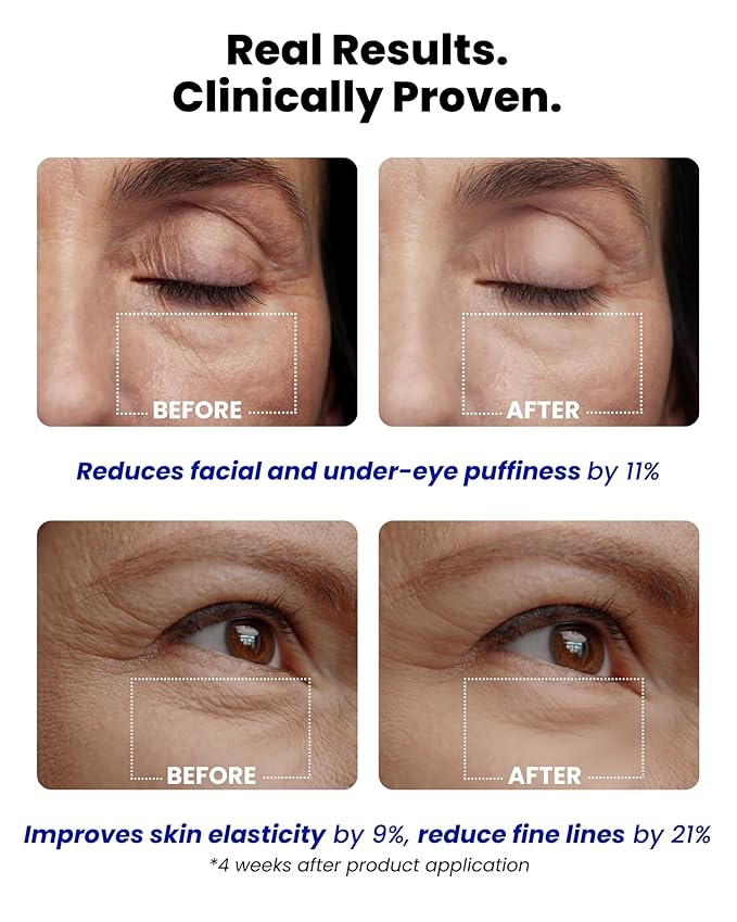 Ice Roll Serum | Cooling & Hydrating Roll-On Serum for Face, Puffy Eyes, Bakuchiol & Collagen for Firming & Lifting, Facial Roller for Depuffing, Under Eye Bag Treatment | Korean Skin Care-Velvo Beauty