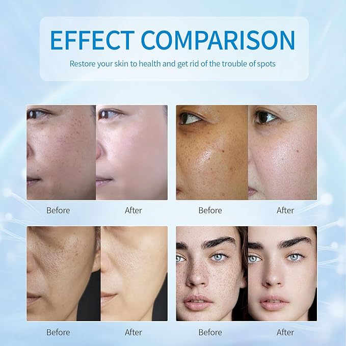 Dark Spot Remover for Face,Dark Spot Corrector, Dark Spot Serum for Sun Spots, Age Spots, Brown Spots,Acne Scars,Melasma Brown Spot -Advanced Formula with Niacinamide Retinol for Women (1.0 Fl Oz)-Velvo Beauty