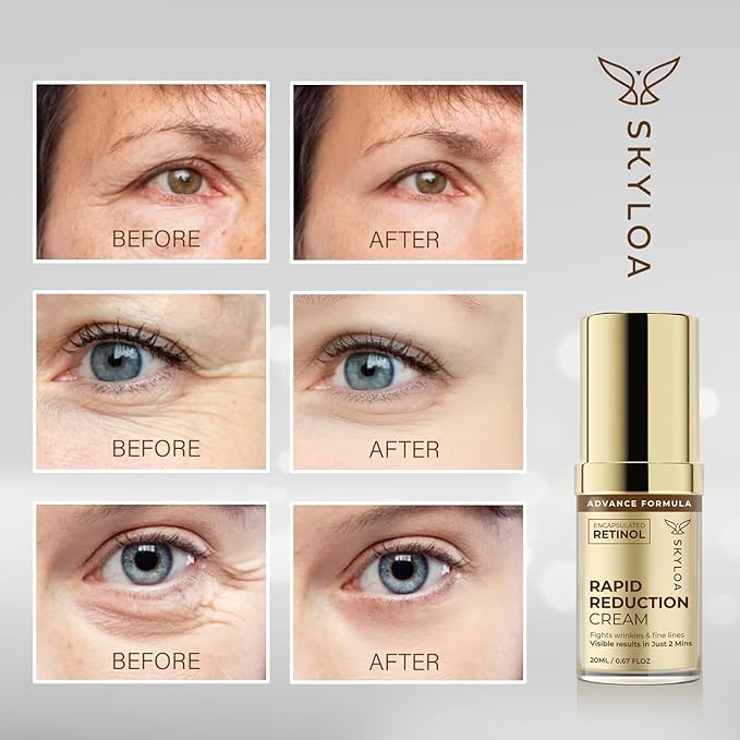 Retinol Eye Cream Anti Aging: Under Eye Cream for Dark Circles and Puffiness Bags - Retinol Eye Serum - Under Eye Serum with Caffeine and Hyaluronic Acid - Visibly Reduces Wrinkles Fine Lines(20ML)-Velvo Beauty