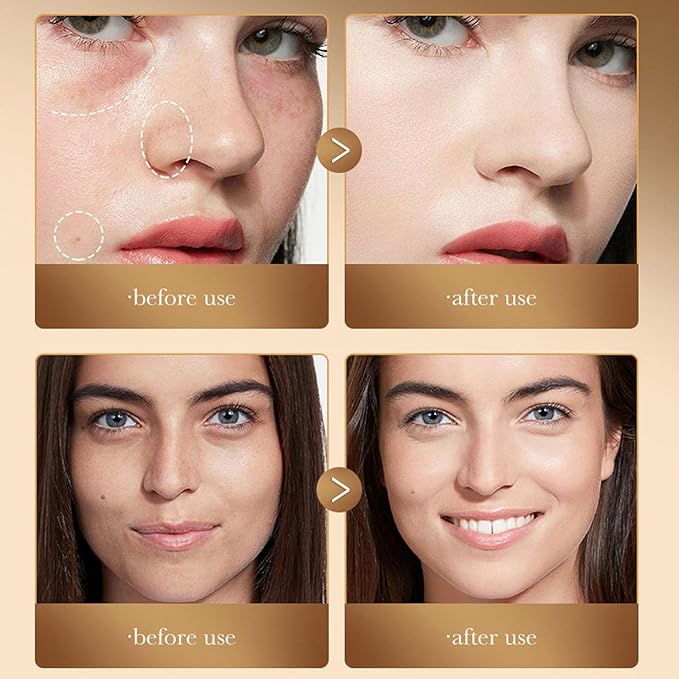 Full Coverage Concealer Palette Tri-Color Correcting Cream Foundation Makeup, Conceal Redness, Dark Circles & Acne Marks, Long-lasting Waterproof Fawless Blendable Brighten Contour Palette-Velvo Beauty