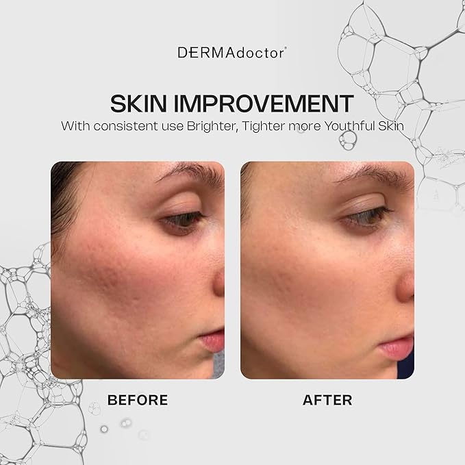 DERMAdoctor Vitamin C Face Serum 20% Vitamin C, Vitamin-E, Ferulic Acid, Ascorbic Acid Concentrated Dermatologist-Formulated Anti-Aging, Hydrating & Discoloration Correcting Serum for Face -1.0 fl oz-Velvo Beauty