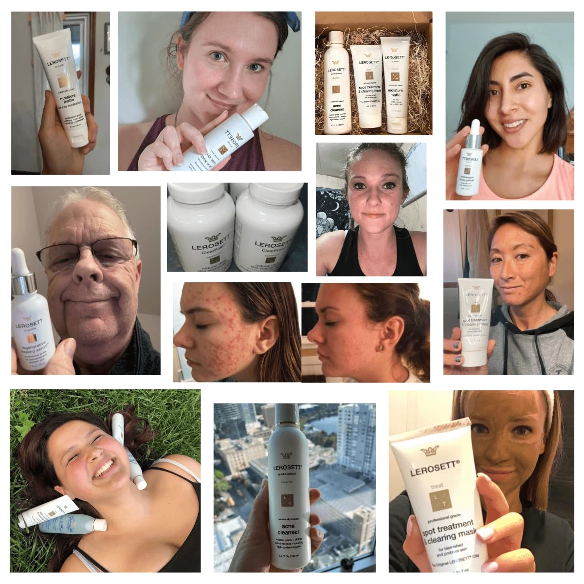 LEROSETT Serum for Acne Scarring Healing, Pimples, Redness, Breakouts, Blemishes, Hydrate & Soothes Irritated Skin, Natural Serum. Spa-Grade, Plant Based, Concentrated - 1 oz-Velvo Beauty