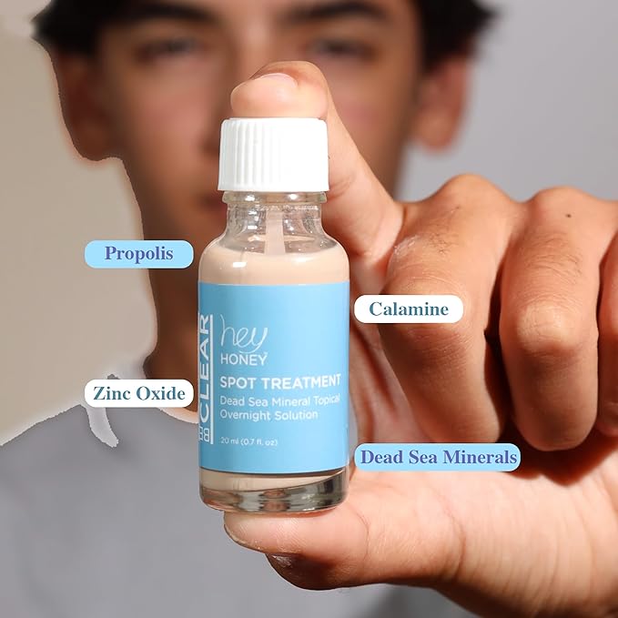 Hey Honey Skincare Be Clear - Acne Spot Treatment Overnight, Pimple Drying Lotion, Use Over Zits Whitehead & Blemishes 1 OZ-Velvo Beauty