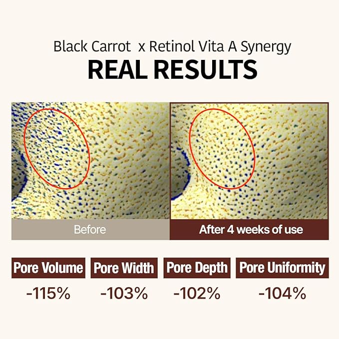 GOODAL Black Carrot VITA-A Retinol Ampoule 30ml, Hydration Facial Serum for Glowy Skin, Lightweight Serum, Korean Skincare, Pore minimizer-Velvo Beauty