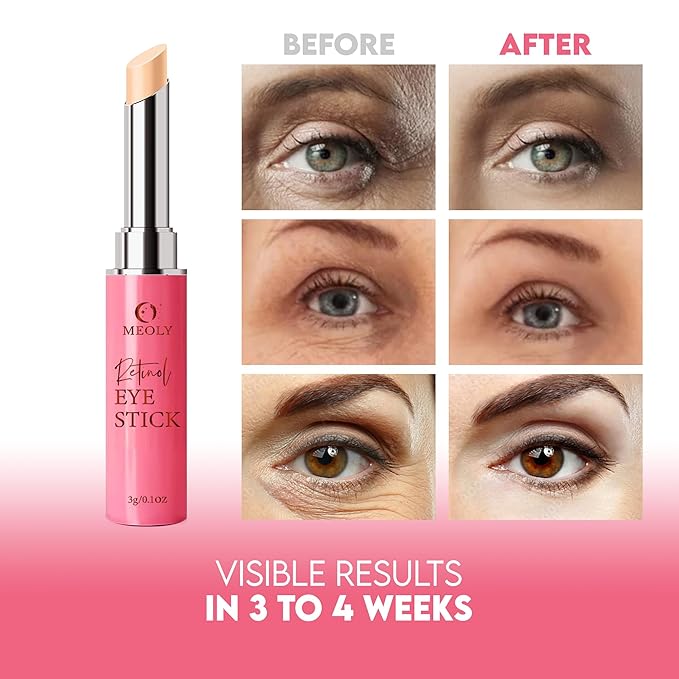 Instant Eye Bag Remover, Retinol Eye Cream for Dark Circles, Under Eye Brightener Stick, Under Eye Cream Anti Aging, Eye Cream for Wrinkles, Brightening Eye Cream for Puffiness and Bags-Velvo Beauty