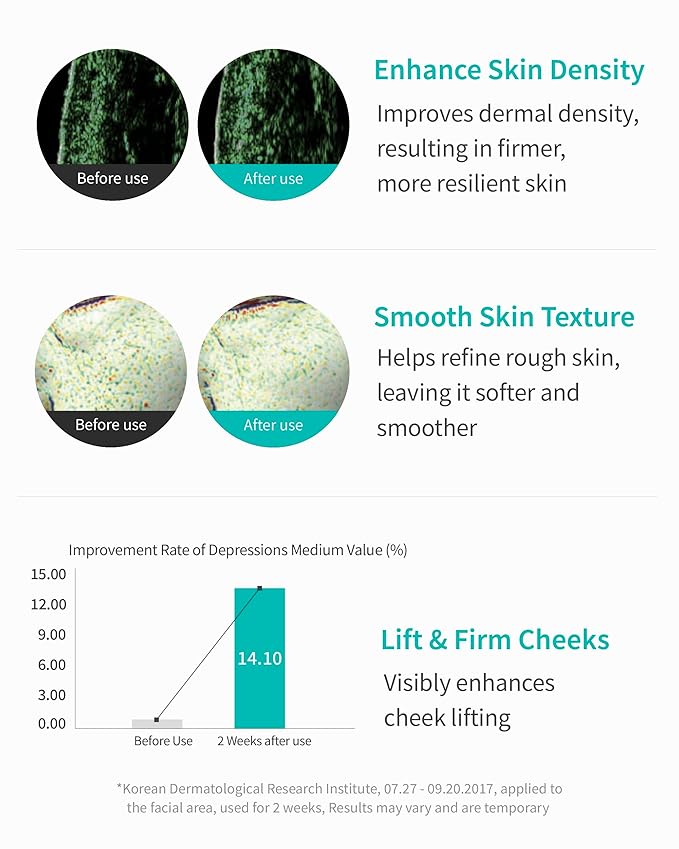 REJURAN® Turnover Ampoule, c-PDRN® – Original Salmon DNA PDRN Face Serum for Rejuvenation, Firming, Hydration & Youthful Glow, Refines Skin Texture. Korean Skincare (1.01 fl oz)-Velvo Beauty