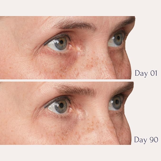 Tru Alchemy Eye Elixir Cooling Eye Treatment Cream - Dark Circle Eye Cream for Puffiness and Bags Under Eyes - Caffeine, Hyaluronic Acid, Vitamin C-Velvo Beauty