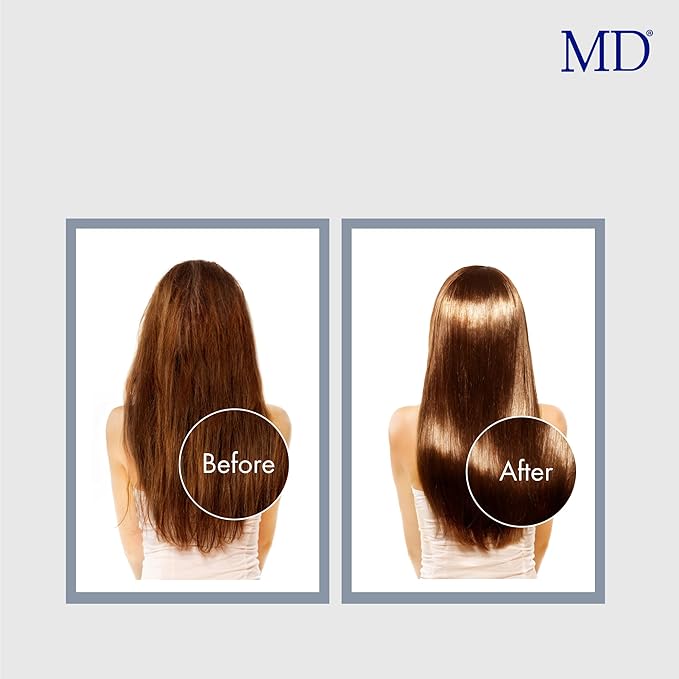 MD Revitalizing Shampoo for Men & Women – Sulphate-Free Hair Thinning Shampoo with Aloe Vera, Chamomile – Hair Loss, Regrowth Anti Thinning Shampoo for All Hair Types-Velvo Beauty