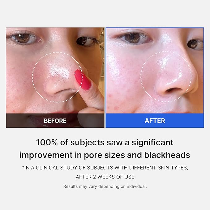 Medicube All-in-One Duo for Pore and Skin Texture Care: Zero Pore Pads 2.0 and Zero Pore Blackhead Mud Facial Mask-Velvo Beauty