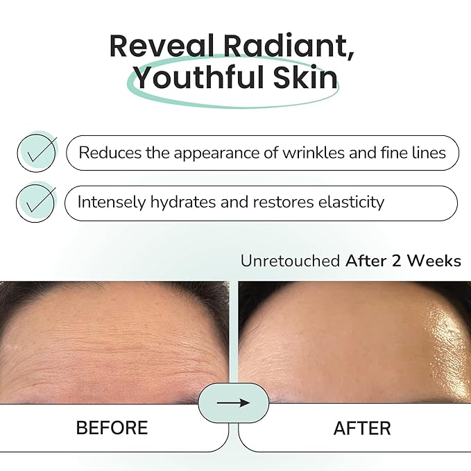 Advanced Forehead Wrinkle Patches Overnight - Anti Wrinkle Patches with Collagen, Peptides, Vitamin E - Strong Adhesion with Full Coverage for Forehead Wrinkles & 11 Lines, Made in Korea, 10 Count-Velvo Beauty