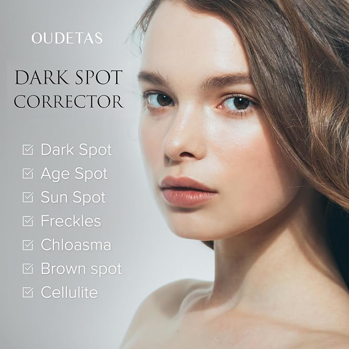Dark Spot Remover for Face: Remove Sun & Age Spot Corrector – Melasma & Hyperpigmentation Brightening Serum for Body(Hand Leg Arm) – Brown Skin and Freckles Removal Treatment with Roller 15ml-Velvo Beauty