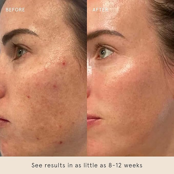Barefaced Serum Duo - RetinAL & Liquid Gold to Hydrate, Even Skin Tone, & Reduce Signs of Aging-Velvo Beauty