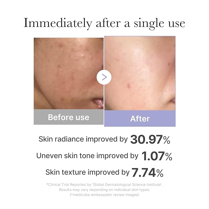 medicube Mini Booster Pro White | Affordable At-Home Facial Skin Care Tool for Beginners - Portable Glow Booster for Glass Skin, Boosting Skin Care Absorption, Skin care for teens, Korean Skin Care-Velvo Beauty