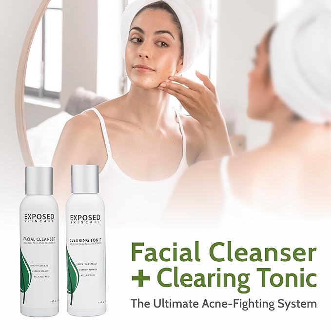 Exposed Skin Care Acne Treatment Kit - Includes Facial Cleanser, Clearing Tonic, Acne Treatment Serum, Clear Pore Serum, Clarifying Mask, Cloth - Natural Acne Solution for Face, All Ages & Skin Types-Velvo Beauty