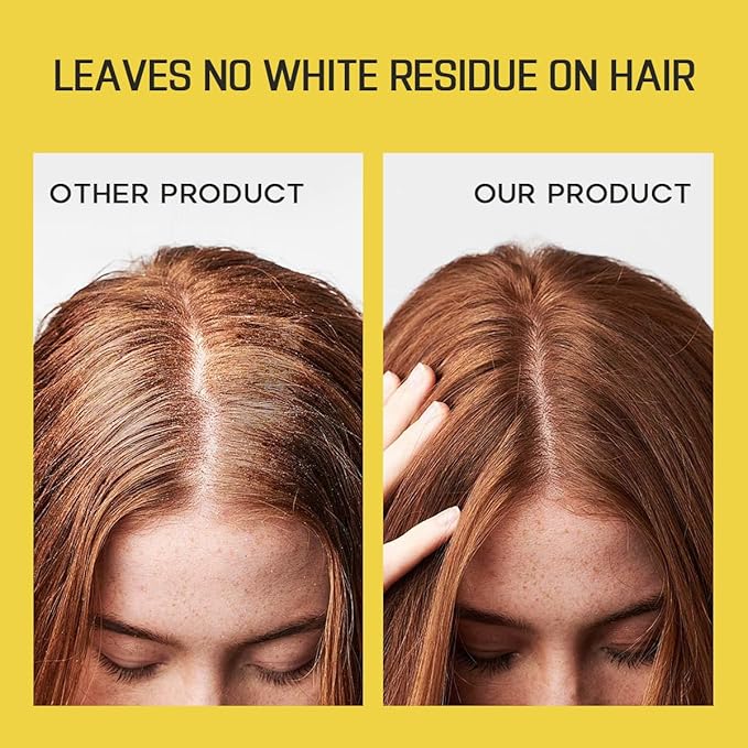 Dry Shampoo for Women, Dry Scalp Shampoo Spray for Dark Hair Leaves No White Residue, Absorb Oils, Volumizing & Refresh Hair for 72 Hours, 5.07 Fl Oz((Pack of 2)-Velvo Beauty