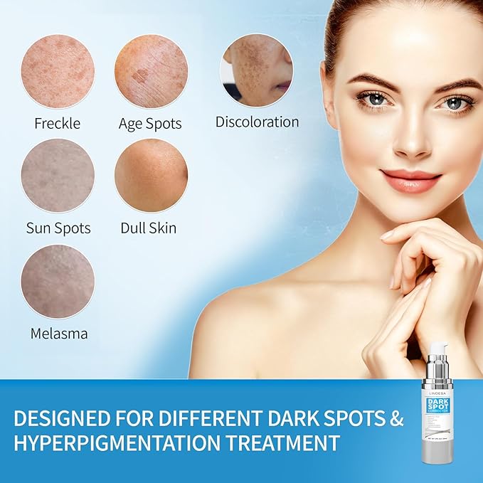 Dark Spot Remover for Face,Dark Spot Corrector, Dark Spot Serum for Sun Spots, Age Spots, Brown Spots,Acne Scars,Melasma Brown Spot -Advanced Formula with Niacinamide Retinol for Women (1.0 Fl Oz)-Velvo Beauty
