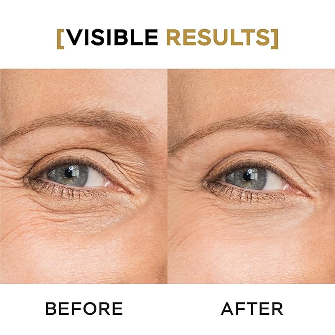 Moisturizing Eye Cream w/Aloe Vera, Collagen, Hyaluronic Acid, Cotton Stem Cells for Dark Circles, Puffiness & Bags - Under Eye Hydration Cream for Women & Men (1 Fl Oz)-Velvo Beauty