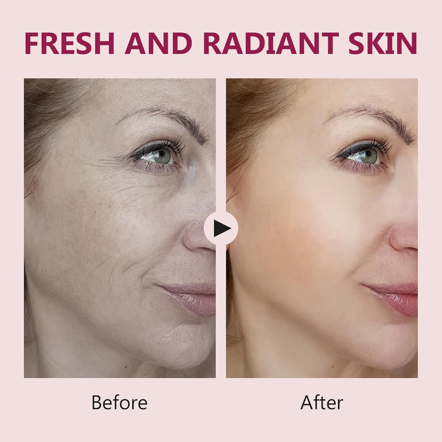 Salmon DNA Ampoule, Microneedling Serum, Anti-Wrinkle & Scar Removal for Face and Body, Salmon DNA Serum Ampoule Anti-wrinkle and Enhance Barrier Function-Velvo Beauty