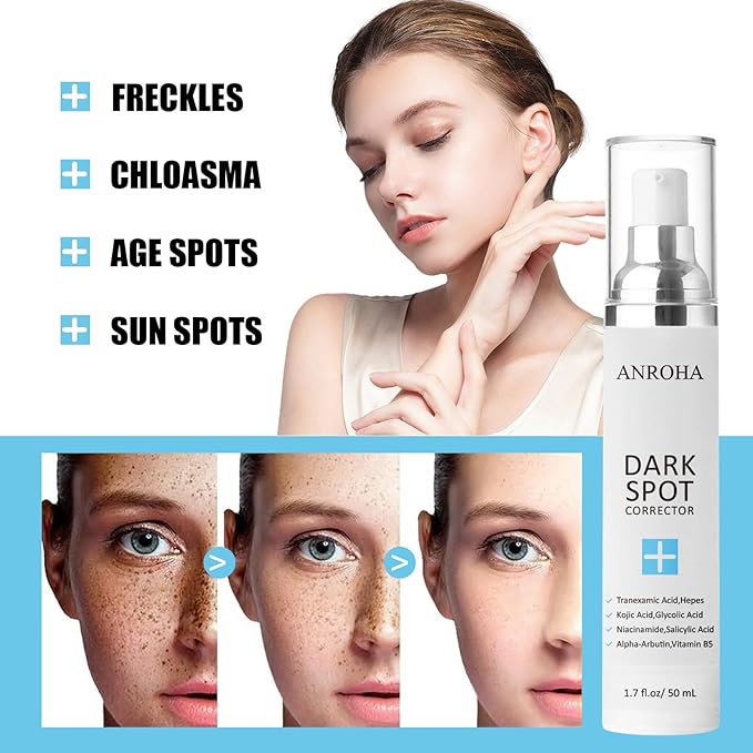 Dark Spot Remover for Face and Body Serum Promotes Anti-Aging Effect -Dark Spot Corrector for Women and Men with Niacinamide Kojic Acid & Salicyic Acid 50ml /1.7fl oz-Velvo Beauty
