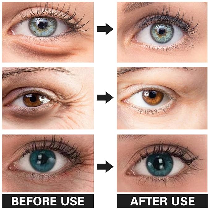 Eye Cream for Dark Circles Bags Eye Cream Eye Products Under Eye Bags Dark Circles-Velvo Beauty