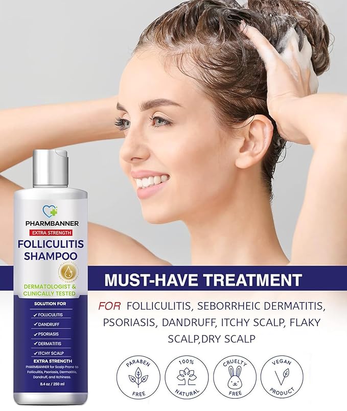 Anti-Fungal Shampoo for Itchy, Dry Scalp – Supports Scalp Health, Helps with Folliculitis, Seborrheic Dermatitis & Scalp Flaking-2 Pack-Velvo Beauty