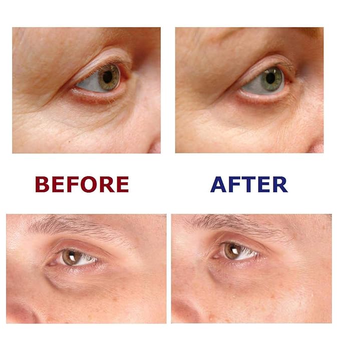 Under Eye Repair Cream - All-Trans-Retinol UNDER EYE REVIVE Anti Aging Eye Cream For Dark Circles And Puffiness, Under Eye Bags, Fine lines, Wrinkles - 0.5 Oz-Velvo Beauty