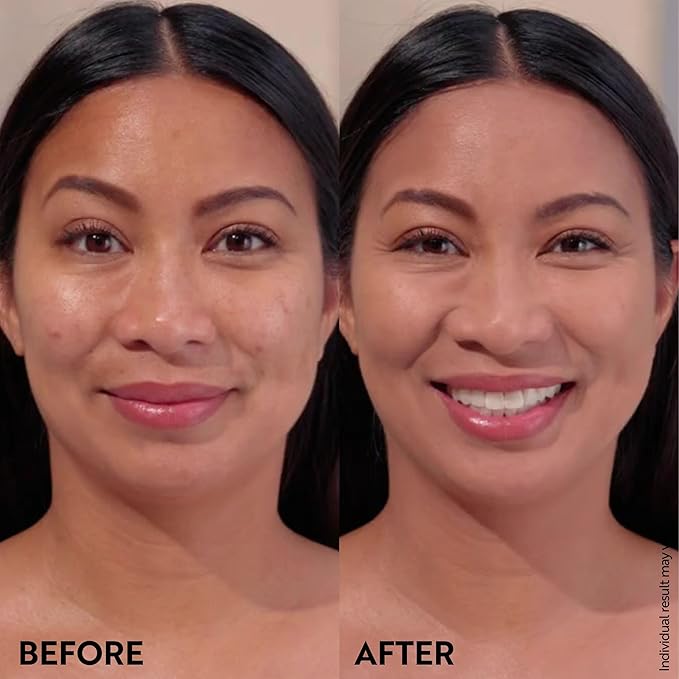 M. Asam Magic Finish Summer Teint Make-Up Mousse (1.01 Fl Oz) – 4in1 Primer, Foundation, Concealer & Powder With Buildable Coverage, Hides Redness And Dark Spots, Vegan, For Medium To Deep Skin Tones-Velvo Beauty