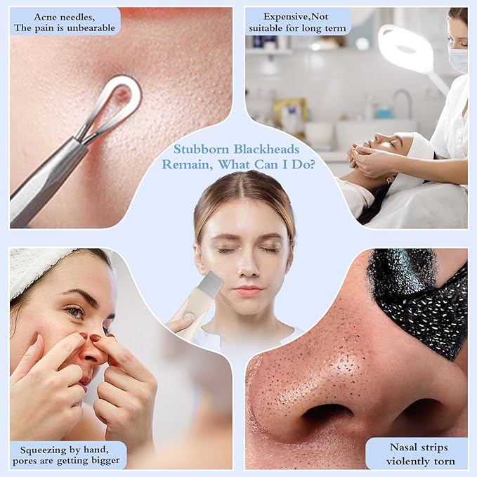 Skin Scrubber Face Spatula Skin Spatula Pore Cleaner Blackhead Remover Tools for Facial Deep Cleansing Skin Care Tool for Men and Women (Beige)-Velvo Beauty