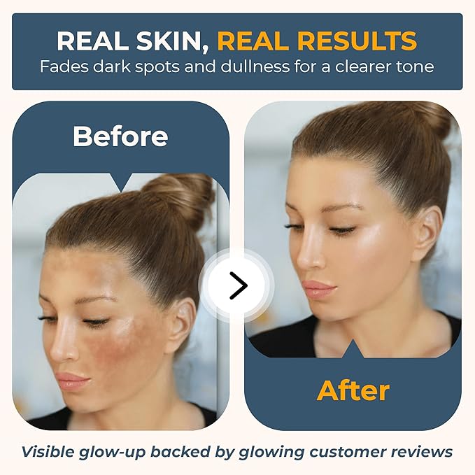Vitabri Vitamin C Serum for Face – Brightening & Anti-Aging Formula with Vitamin C, Ferulic Acid & Botanicals – Hydrating Serum for Dark Spots, Tone & Fine Lines – 1 Fl Oz-Velvo Beauty