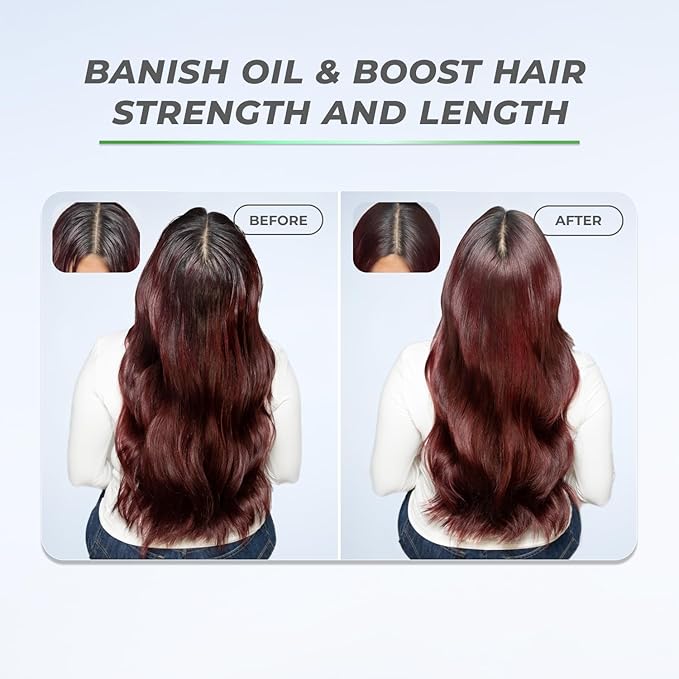 XMONDO Hair BOOST X Dry Shampoo, Zero Residue, Formulated with Saw Palmetto to Promote Scalp Care, Clinically Tested, Dermatologist Tested, Talc-free, Benzene-free, Free of aluminum starch, 5 oz-Velvo Beauty
