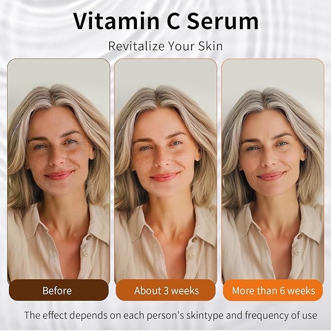 Vitamin C Retinol Serum for Face, Brightening & Anti-Aging with Hyaluronic Acid, Vitamin E, Peptides, Collagen - Hydrates, Firms, Lifts, Smooths, Targets Age Spots, Wrinkles, 1.7 Fl Oz-Velvo Beauty