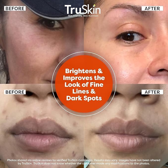 TruSkin Vitamin C Serum For Face – Anti Aging Face Serum with Vitamin C, Hyaluronic Acid, Vitamin E – Brightening Formula – Improve Appearance of Dark Spots, Tone, Fine Lines & Wrinkles, 1 Fl Oz-Velvo Beauty