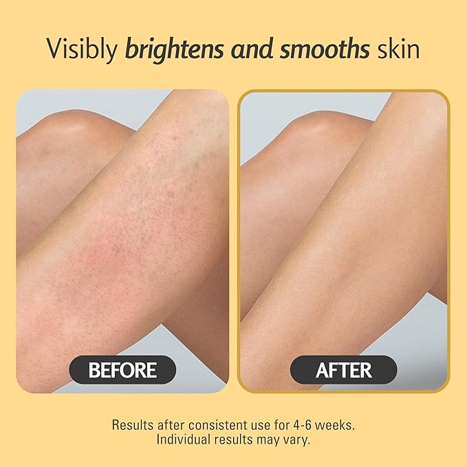 Exfoliating Turmeric Scrub and Skin Exfoliator with Collagen and Coconut Oil, Gently Exfoliates Face, Body, Hands, and Feet, Moisturizing Skincare, 16 oz by M3 Naturals-Velvo Beauty