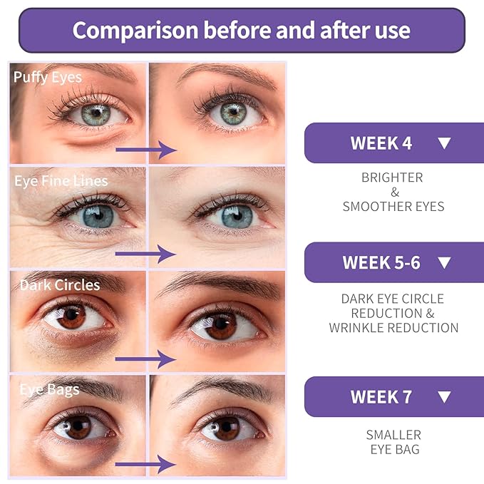 BREYLEE Retinol Eye Cream - Puffy Eyes and Dark Circles Treatments – Look Younger and Reduce Wrinkles and Fine Lines Undereye, Improve and Firm eye Skin - Pure Natural Material Extraction-Velvo Beauty