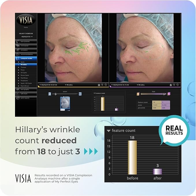My Perfect Eyes 20ml, 200 Applications, Penny Lane, Instant Results, Clinically Proven, Anti-Ageing Serum UK Original Formula, Science-Backed Anti-Wrinkle Serum. As Seen on TV.-Velvo Beauty