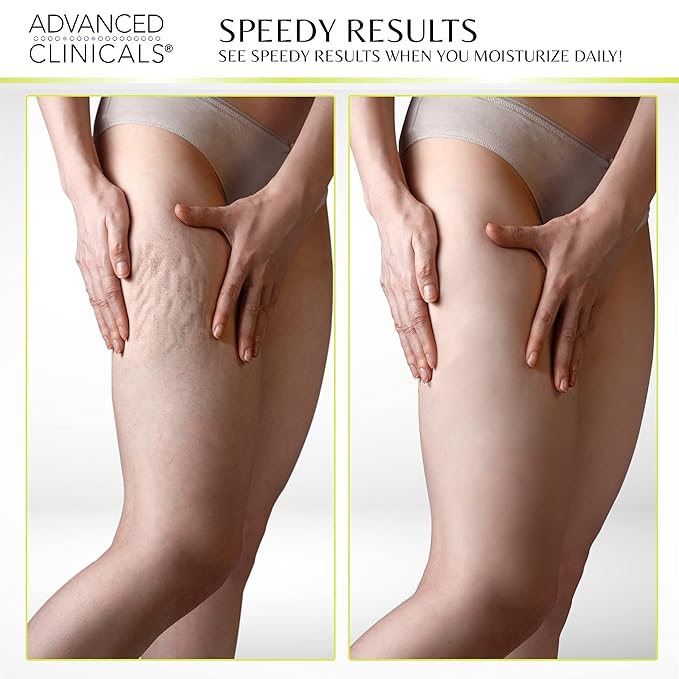 Advanced Clinicals Thermo Firming Green Coffee Bean Moisturizer Body Cream | Anti Cellulite Caffeine Firming Lotion For Legs, Arms, & Body | Skin Care Products | Aging Skin Tightening Cream, 2-Pack-Velvo Beauty
