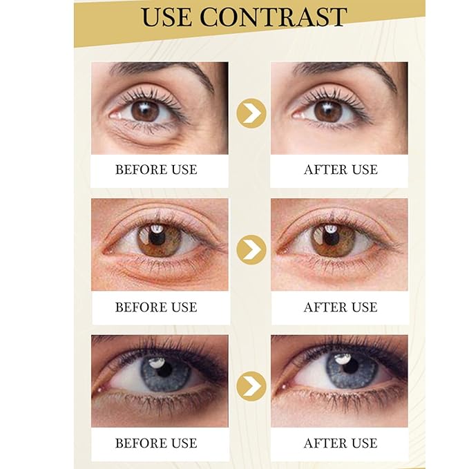 Polypeptide Eye Cream for Dark Circles,Bags Under and Puffiness,Polypeptide Eye Cream Anti Aging Firming Eye Cream,Wrinkie Removal Dark Circles Remove Eye Bags Nourishing Eye Serum Skin Care-Velvo Beauty