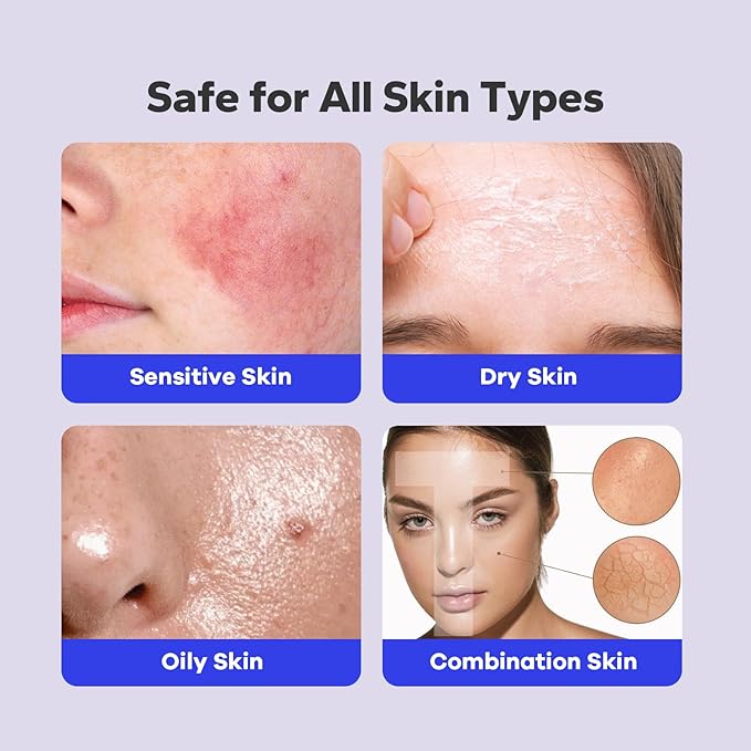 Salicylic Acid Spray (5.07 Fl Oz), 2% Salicylic Acid Body Spray, Body Acne Treatment for Bacne, Blackheads & Blemishes, Back & Chest Acne Spray for Face & Body, 360° Mist for All Skin Types-Velvo Beauty