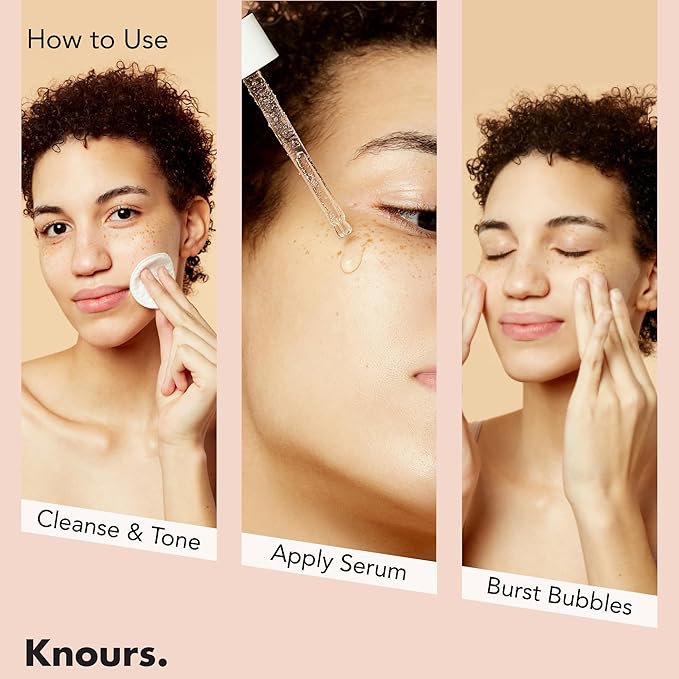 Knours. Balancing 5xHA+Gromwell Root oil Bubble Burst Serum w/ 59% Rose Water Niacinamide, Retinal Hydrating Healthy Serum for Improved Tone & Texture EWG Verified Clean Beauty 50ml/1.69fl. oz.-Velvo Beauty