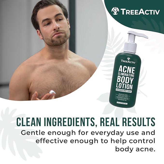 TreeActiv Acne Eliminating Body Lotion 8 fl oz | Clears Body, Back, Butt and Shoulder Acne | Anti-Acne Moisturizer | Prevents Future Breakouts | Cucumber Mint Scent-Velvo Beauty