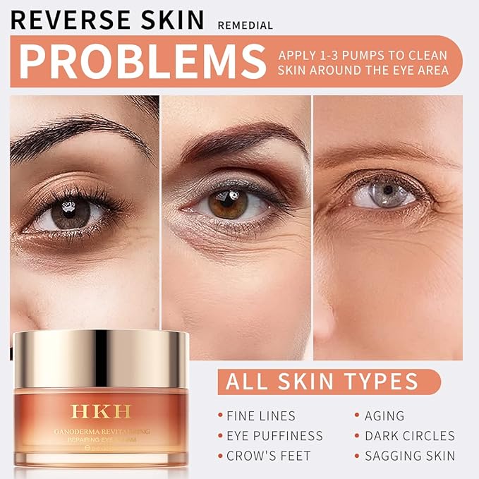 Dark Circles Under Eye Treatment for Women - Eye Cream for Dark Circles Wrinkles Puffiness & Fades Fine Lines, Fade Dark Circles Anti-Aging Collagen Eye Cream – Retinol Peptide-Velvo Beauty