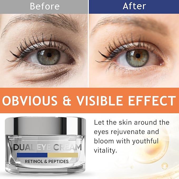 Eye Cream, Dual Eye Cream Anti Aging with Advanced Retinol and Peptides, Under Eye Cream for Dark Circles, Fine Lines, Puffiness and Bags Under Eyes-Velvo Beauty