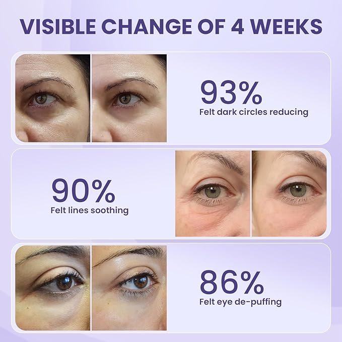 Retinol Eye Cream, Under Eye Cream for Dark Circles and Puffiness, Anti-Aging Eye Cream for Wrinkles, Eye Theatment with Lotus Leaf Extract, Made in USA-Velvo Beauty