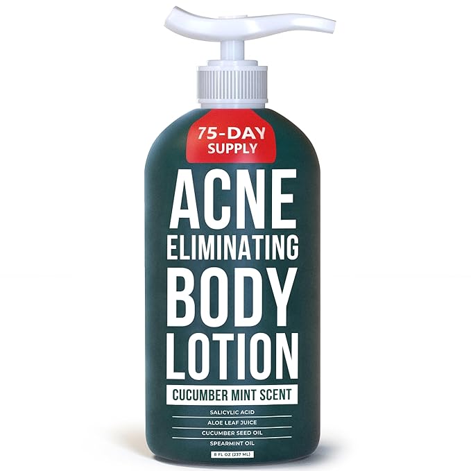 TreeActiv Acne Eliminating Body Lotion 8 fl oz | Clears Body, Back, Butt and Shoulder Acne | Anti-Acne Moisturizer | Prevents Future Breakouts | Cucumber Mint Scent-Velvo Beauty