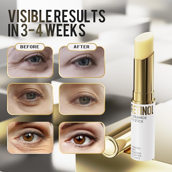 Retinol Eye Stick, Eye Cream for Dark Circles and Puffiness, Eye Brightening Cream for Hydration, Wrinkles in 3-4 Weeks, Travel Portability Anti-Aging Eye Cream for Bags Under Eye Reduces Fine Line-Velvo Beauty