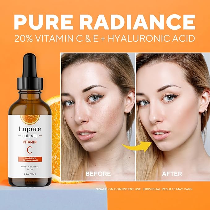 Professional Vitamin C Face Serum 20%, Anti Aging Facial Super Vit C Serum with Ascorbic Acid Hyaluronic Acid & Vitamin E for Dark Spots, Skin Care, Christmas Gift & Stocking | 1 Fl. Oz-Velvo Beauty