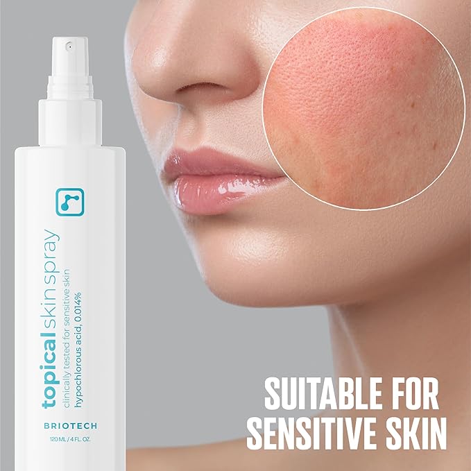 BRIOTECH Topical Skin Spray, Hypochlorous Acid Spray for Sensitive Skin, HOCl Facial Mist, Full Body Support Against Irritation, Calm Redness, Soothe Foot & Scalp, 2 oz Travel Size-Velvo Beauty