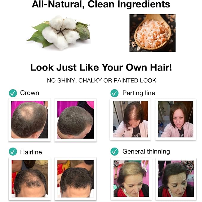 Hair Loss Concealer. Covers Bald Spot And Makes Thin Hair Look 10X Fuller Instantly. All-Natural Hair Building Fiber. Trial Size, 10-Day Supply. Gray-Velvo Beauty