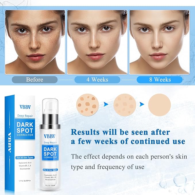 Dark Spot Remover for Face and Body, Dark Spot Corrector, Age Spot Sun Spot Freckles Dark Spot Remover, Melasma Treatment for Face, Advanced Skin Care Cream for Women and Men (1.7 Fl Oz)-Velvo Beauty