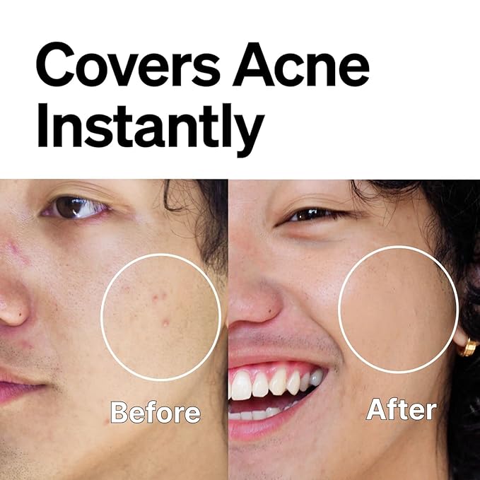FRONTMAN Fade, Men's Acne Concealer With Salicylic Acid | Blemishes & Dark Circles | Natural Coverage, Non-Greasy Formula, Fragrance-Free | Great for All Skin Types | Men’s Concealer M1 Medium Shade-Velvo Beauty